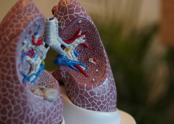 Artificial intelligence diagnoses lung cancer
