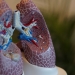 Artificial intelligence diagnoses lung cancer